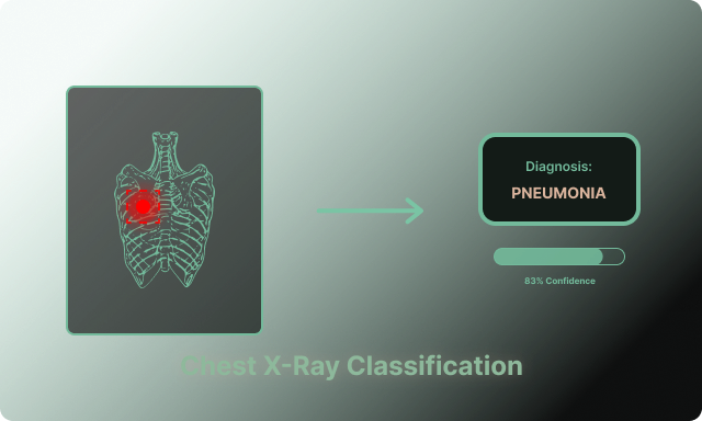 Chest X-Ray Classification